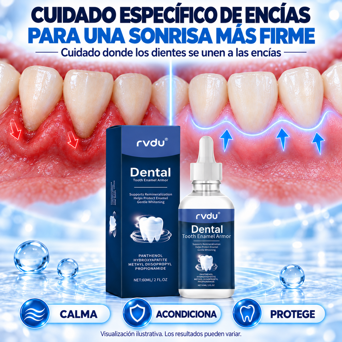 Rvdu Líquido Periodontal Para Encías Dañadas Sensibles Y Retraídas 60 Ml Limpieza De Manchas En Dientes Cuidado De La Línea Gingival