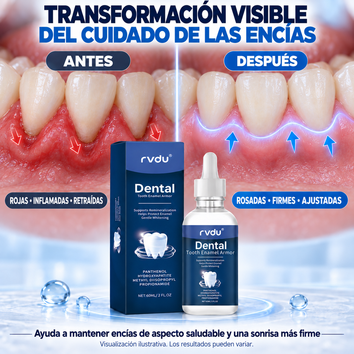 Rvdu Líquido Periodontal Para Encías Dañadas Sensibles Y Retraídas 60 Ml Limpieza De Manchas En Dientes Cuidado De La Línea Gingival