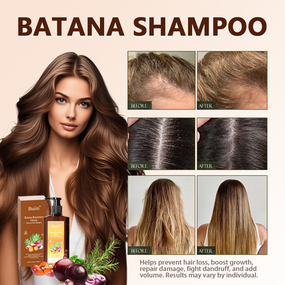 Buiiti Batana Rosemary Onion Three - in - One Anti-Hair Fall HairLoss Treatment Shampoo,Oil Control Antidandruff Haircare,Help HairGrowth For all hair types, natural Haircare