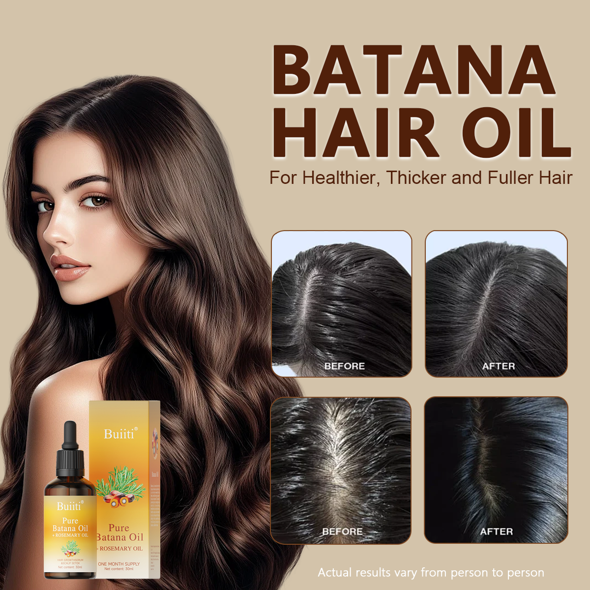 Buiiti Batana & Rosemary Hair Growth Oil for Men & Women -  Improve scalp health&Promotes Healthy Hair Growth, Hair Products, Scalp Health Boost