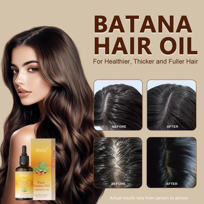 Buiiti Batana & Rosemary Hair Growth Oil for Men & Women -  Improve scalp health&Promotes Healthy Hair Growth, Hair Products, Scalp Health Boost