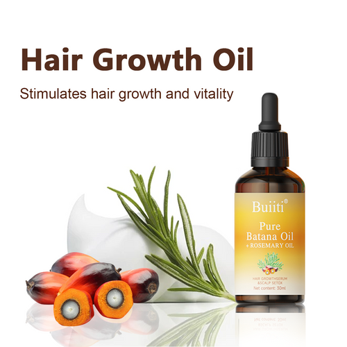 Buiiti Batana & Rosemary Hair Growth Oil for Men & Women -  Improve scalp health&Promotes Healthy Hair Growth, Hair Products, Scalp Health Boost