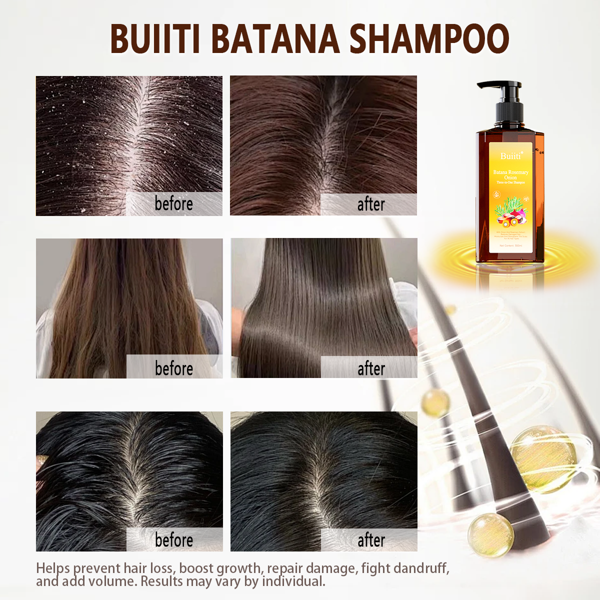 Buiiti Batana Rosemary Onion Three - in - One Anti-Hair Fall HairLoss Treatment Shampoo,Oil Control Antidandruff Haircare,Help HairGrowth For all hair types, natural Haircare