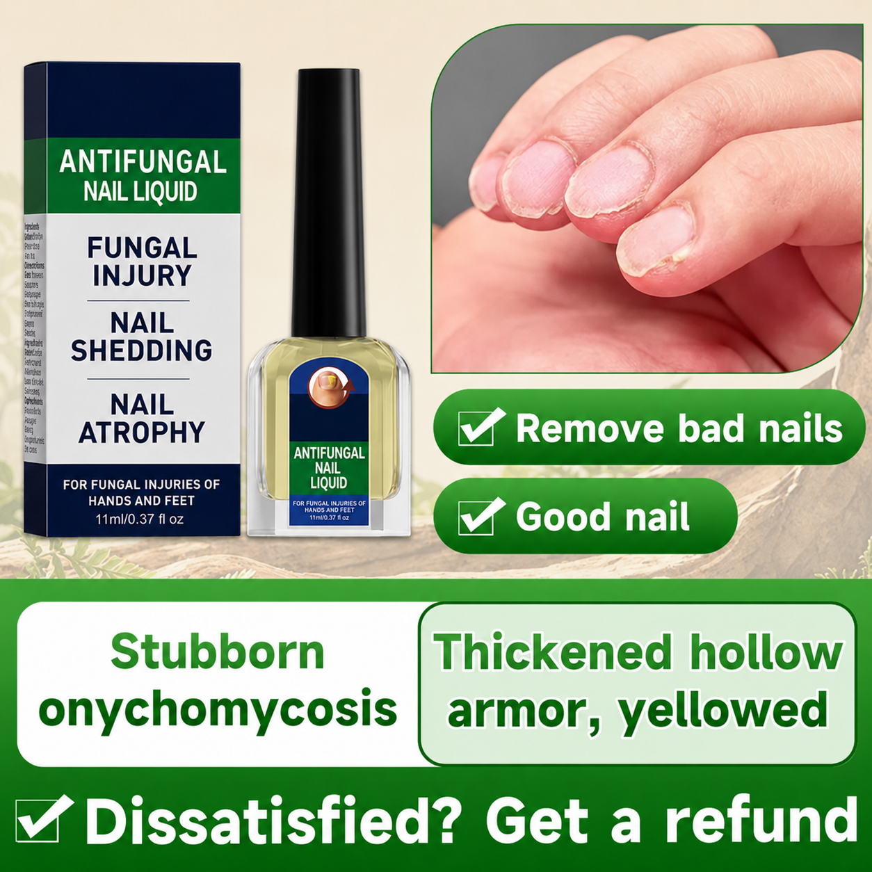 Maximum Strength Comprehensive Toenail Fungus Solution | Triple Action Formula Fights Fungus, Clears Yellow & Thick Nails, Fast Itch Relief.#DealsForYouDays