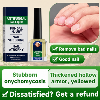 Maximum Strength Comprehensive Toenail Fungus Solution | Triple Action Formula Fights Fungus, Clears Yellow & Thick Nails, Fast Itch Relief.#DealsForYouDays