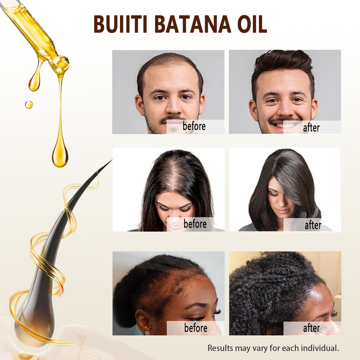 Buiiti Batana & Rosemary Hair Growth Oil for Men & Women -  Improve scalp health&Promotes Healthy Hair Growth, Hair Products, Scalp Health Boost