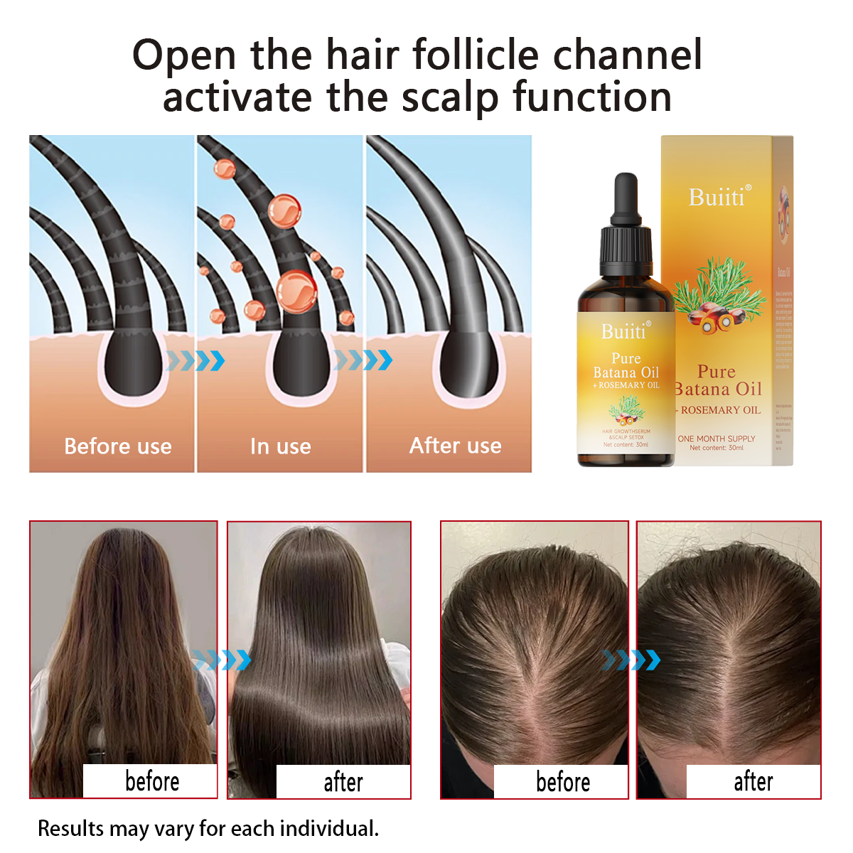 Buiiti Batana & Rosemary Hair Growth Oil for Men & Women -  Improve scalp health&Promotes Healthy Hair Growth, Hair Products, Scalp Health Boost