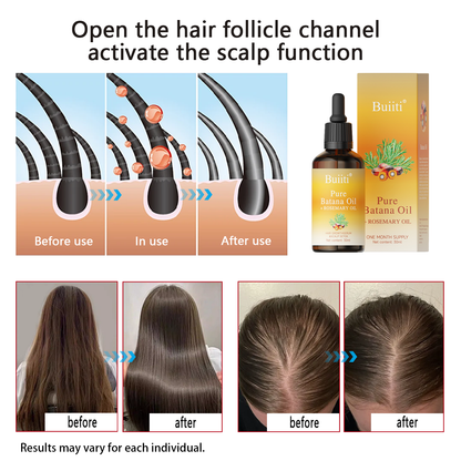 Buiiti Batana & Rosemary Hair Growth Oil for Men & Women -  Improve scalp health&Promotes Healthy Hair Growth, Hair Products, Scalp Health Boost