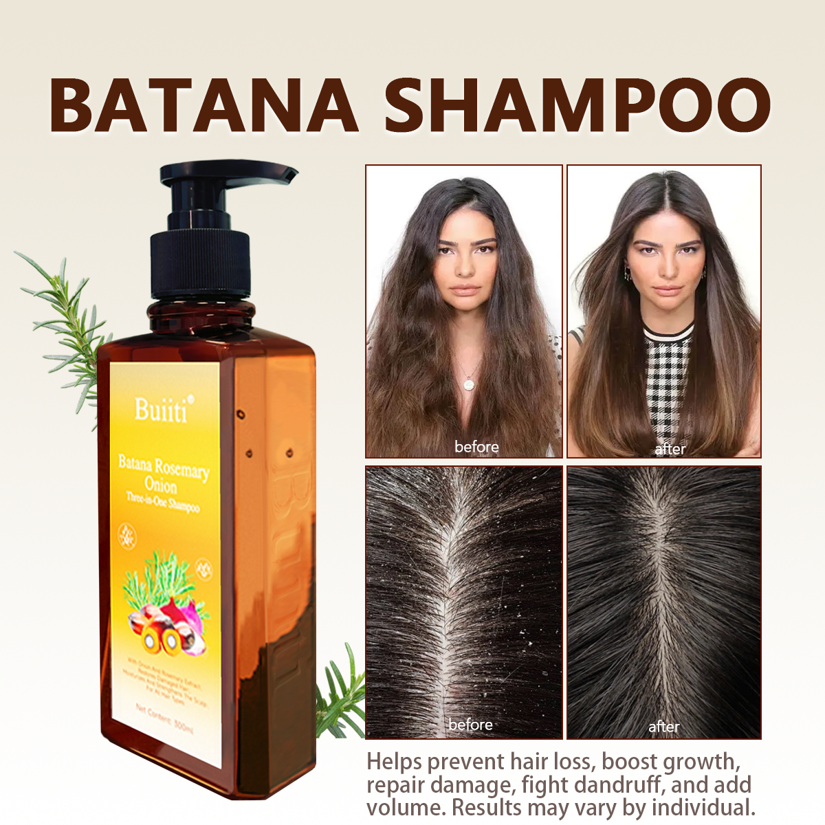 Buiiti Batana Rosemary Onion Three - in - One Anti-Hair Fall HairLoss Treatment Shampoo,Oil Control Antidandruff Haircare,Help HairGrowth For all hair types, natural Haircare